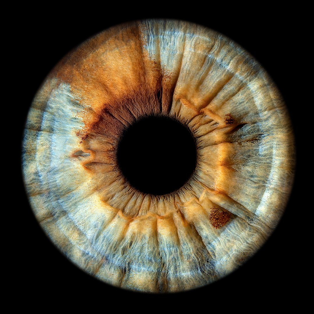 30-second iris editing